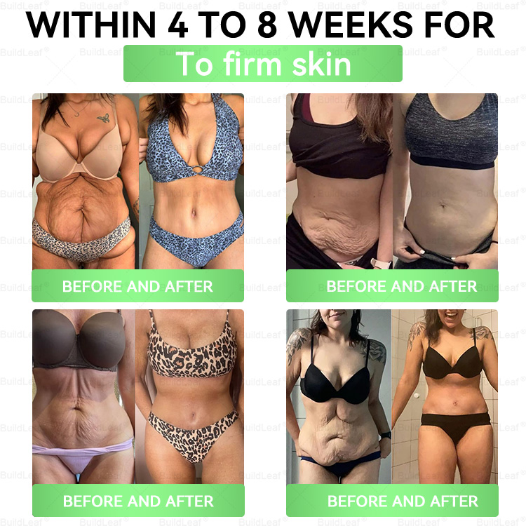 🔥𝘽𝙪𝙞𝙡𝙙𝙇𝙚𝙖𝙛® 𝗚𝗟𝗣-𝟭 𝟖-𝗶𝗻-𝟭 𝗦𝗹𝗶𝗺 & 𝑯𝒆𝒂𝒍𝒕𝒉𝐲 𝑶𝒓𝒂𝒍 𝑺𝒐𝒍𝒖𝒕𝒊𝒐𝒏(𝑂𝑛𝑐𝑒 𝑎 𝑑𝑎𝑦, 𝑣𝑖𝑠𝑖𝑏𝑙𝑒 𝑟𝑒𝑠𝑢𝑙𝑡𝑠 𝑖𝑛 7 𝑑𝑎𝑦𝑠)  ✅ 𝗦𝘂𝗽𝗽𝗼𝗿𝘁𝘀 𝗼𝗯𝗲𝘀𝗶𝘁𝘆, 𝗰𝗮𝗿𝗱𝗶𝗼𝘃𝗮𝘀𝗰𝘂𝗹𝗮𝗿 𝗵𝗲𝗮𝗹𝘁𝗵, 𝗱𝗶𝗮𝗯𝗲𝘁𝗲𝘀, 𝘀𝗹𝗲𝗲𝗽 𝗮𝗽𝗻𝗲𝗮, 𝗴𝘂𝘁 𝗵𝗲𝗮𝗹𝘁𝗵, 𝗷𝗼𝗶𝗻𝘁 𝗶𝘀𝘀𝘂𝗲𝘀, 𝐰𝐡𝐢𝐥𝐞 𝐚𝐥𝐬𝐨 𝐟𝐢𝐫𝐦𝐢𝐧𝐠 𝐭𝐡𝐞 𝐬𝐤𝐢𝐧 𝐚𝐧𝐝 𝐛𝐨𝐨𝐬𝐭𝐢𝐧𝐠 𝐞𝐧𝐞𝐫𝐠𝐲.