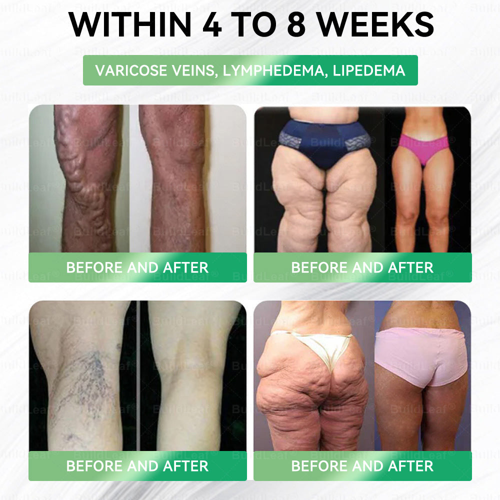 🇺🇸BuildLeaf® GLP-1 8-in-1 Slim & Healthy Oral Solution (Once a day, results in 7 days), With 100 Billion CFU Active Probiotics ✅ Supports weight management, heart health, diabetes, gut & women’s health, while firming skin & boosting energy.