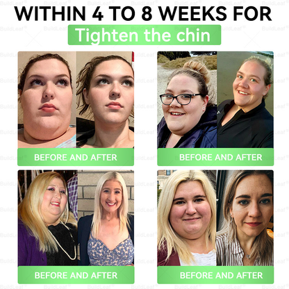 🇺🇸BuildLeaf® GLP-1 8-in-1 Slim & Healthy Oral Solution (Once a day, results in 7 days), With 100 Billion CFU Active Probiotics ✅ Supports weight management, heart health, diabetes, gut & women’s health, while firming skin & boosting energy.